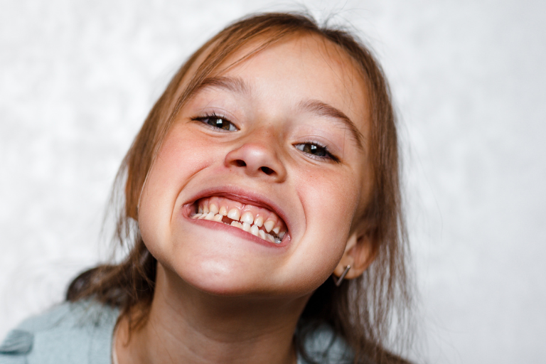 Clínica Villalaín. Qué hacer ante un traumatismo dental