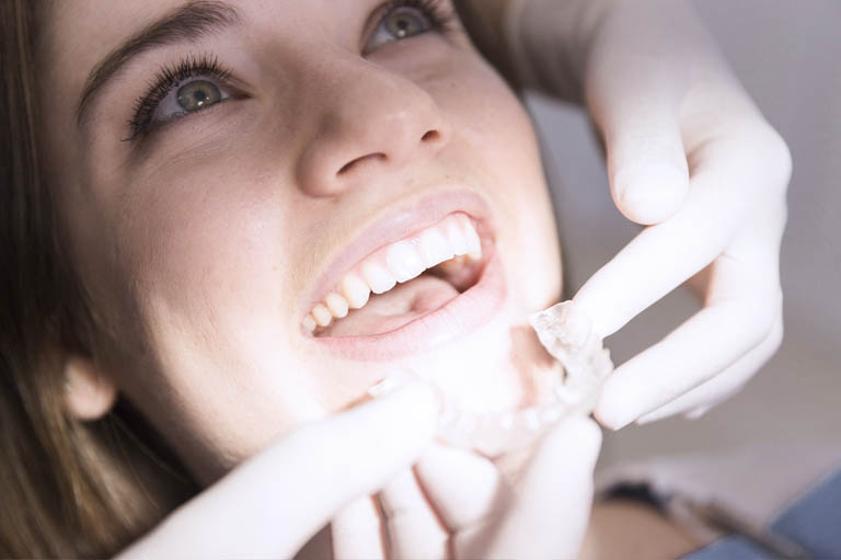 tratamientos dentales, expertos en invisalign aviles