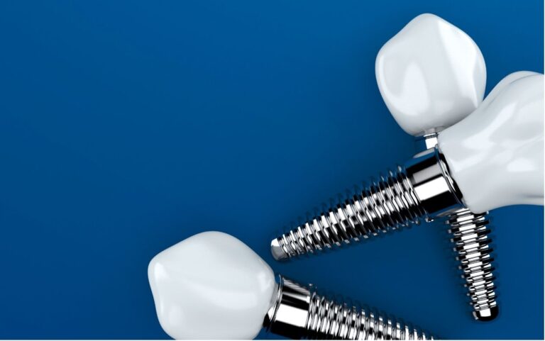 mitos sobre implantes dentales en aviles asturias clinica dental villalain