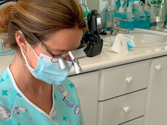 Lupas dentales en una clínica dental en Avilés