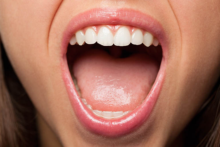 Clínica Dental Villalaín. Importancia de la higiene lingual