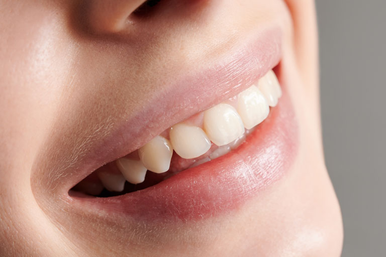 anomalías en la forma de los dientes
