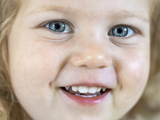 caries en bebés