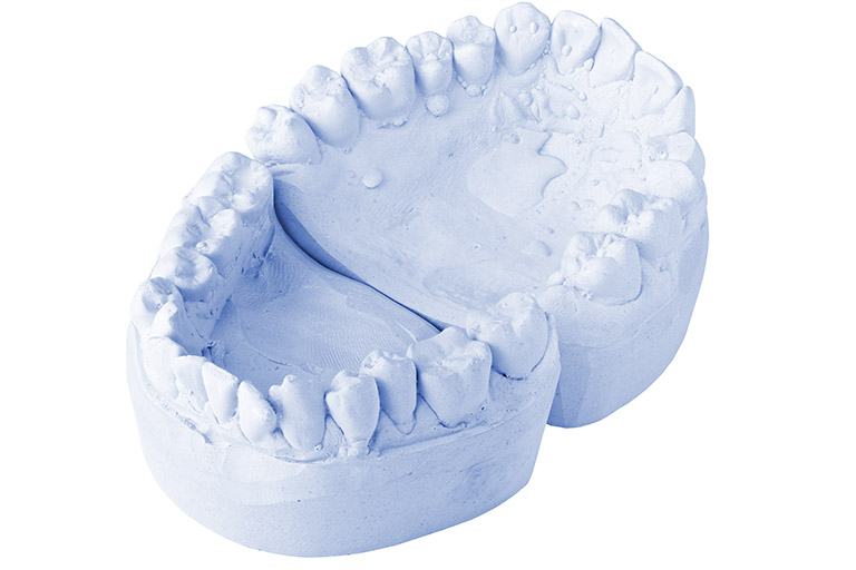 impresión en odontología
