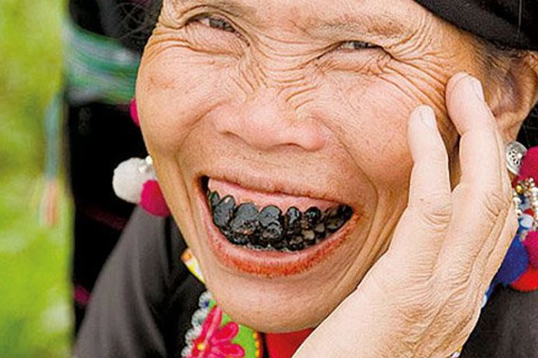 Dientes Negros en la cultura Japonesa | Clínica Dental Villalaín