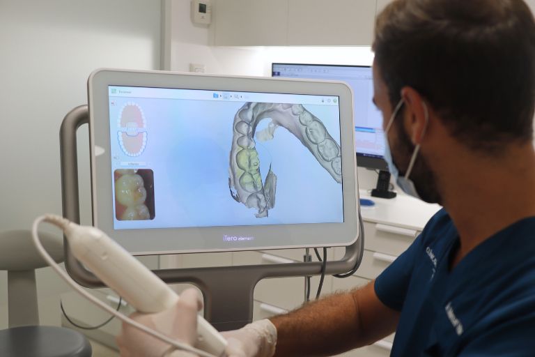 El escáner Intraoral - Clínica Dental Villalain - Clínica Dental Avilés