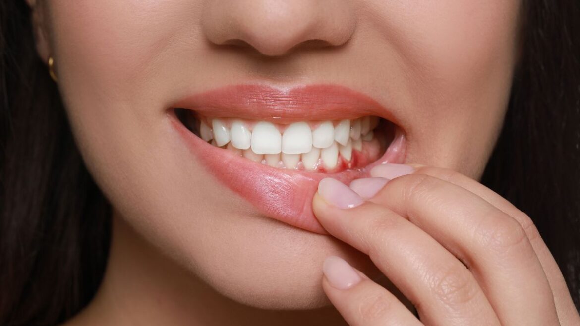 La inflamación de encías es un problema que hay que solucionar para evitar problemas mayores - Dentista en Avilés