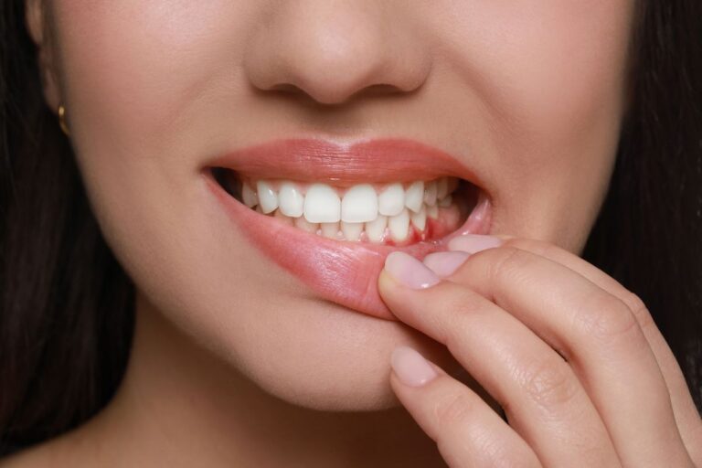 La inflamación de encías es un problema que hay que solucionar para evitar problemas mayores - Dentista en Avilés