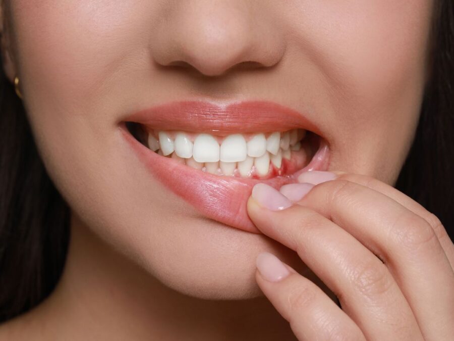 La inflamación de encías es un problema que hay que solucionar para evitar problemas mayores - Dentista en Avilés