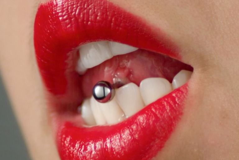 Consecuencias de los piercing en la boca. Tu clínica dental de confianza en Avilés te informa
