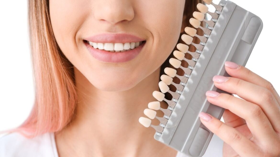 Cuidados recomendados después del blanqueamiento dental