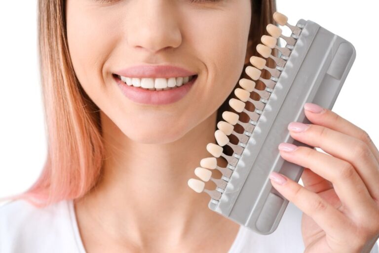 Cuidados recomendados después del blanqueamiento dental