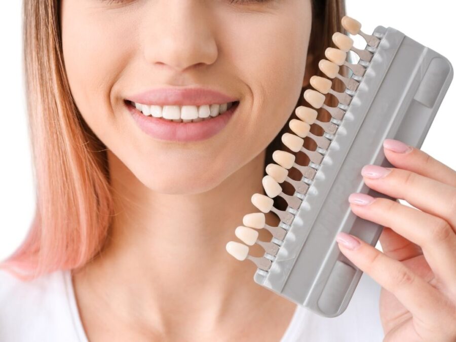 Cuidados recomendados después del blanqueamiento dental