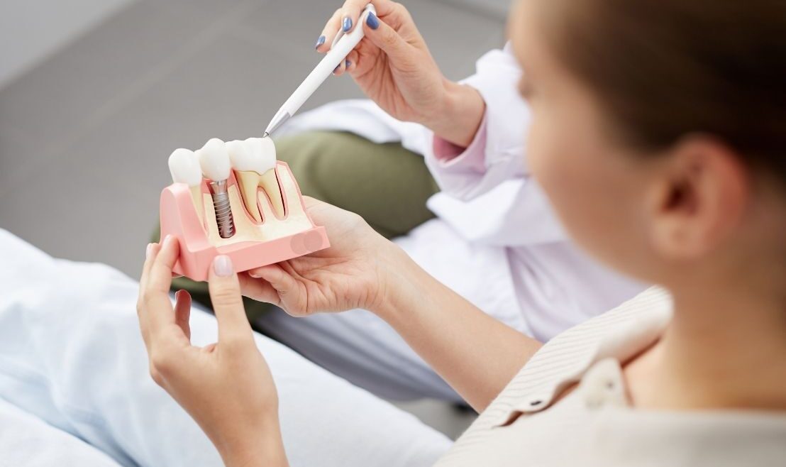 Implante dental ortodoncia en Avilés clinica villalaín