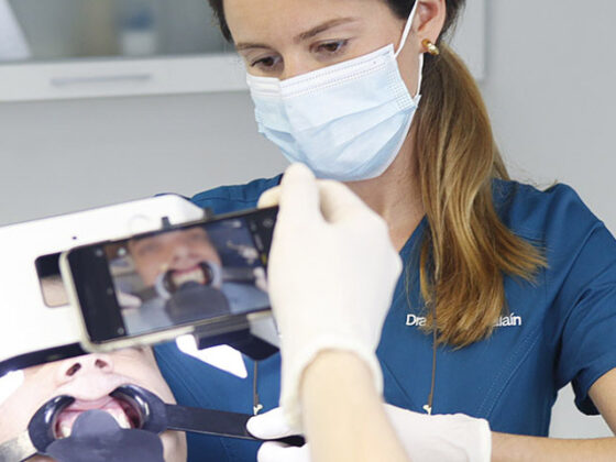 Todo sobre blanqueamiento dental. Clínica Villalaín, tu dentista en Avilés