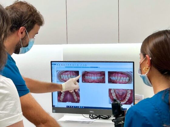 Cuándo se notan los resultados de Invisalign. Clínica Villalaín, expertos en ortodoncia en Avilés