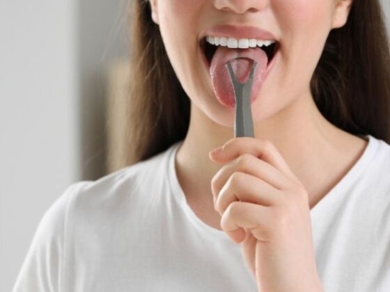 Remedios para aliviar el picor en la lengua